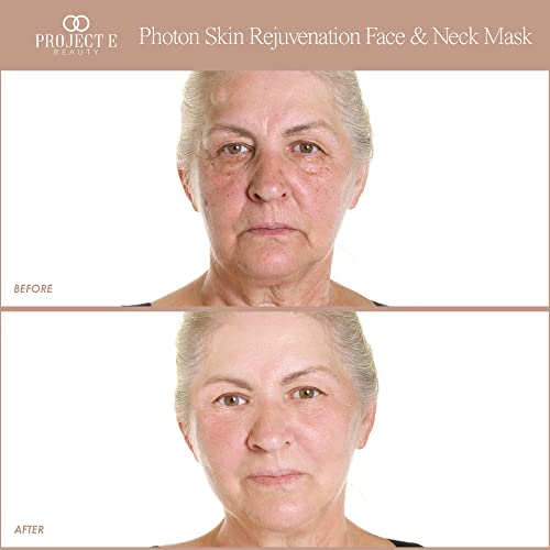 LED Face & Neck Mask for Anti-Aging and Acne