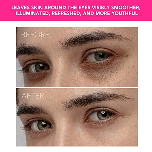 Foreo Iris Eye Massager for Dark Circles