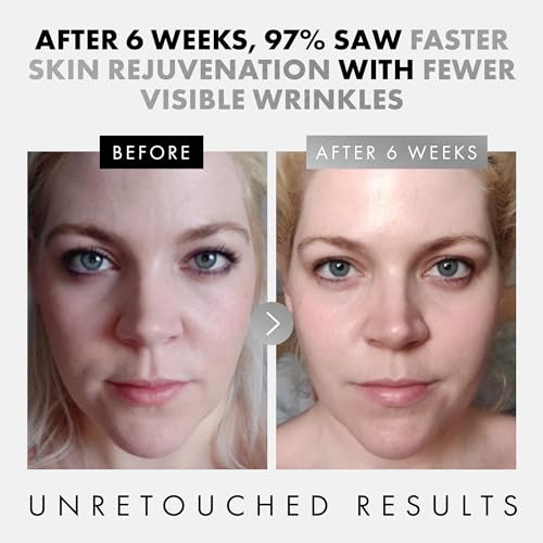 Eclat 3-Pack Face Serums for Youthful Skin