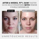 Eclat 3-Pack Face Serums for Youthful Skin