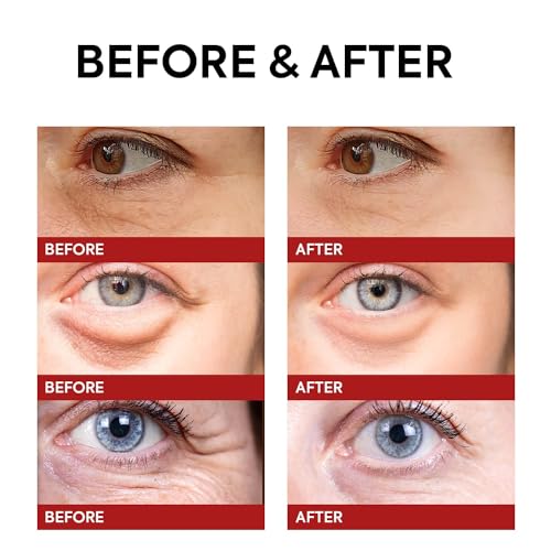 Instant Wrinkle-Reducing Retinol Eye Cream