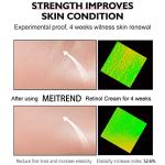 Retinol Face Cream for Anti-Aging and Moisturizing