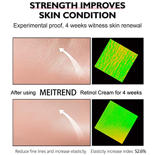 Retinol Face Cream for Anti-Aging and Moisturizing