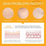 Teen Skincare Set: Ultimate Beauty Essentials