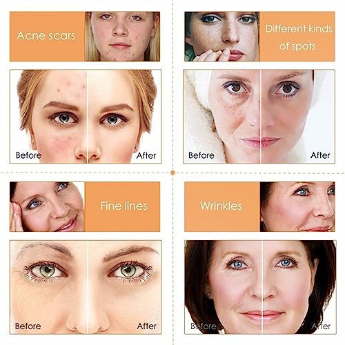 Teen Skincare Set: Ultimate Beauty Essentials