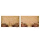 ROC Retinol Correxion Line Smoothing Hydration 50ml