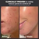 Paula's Choice 2% BHA Liquid Exfoliant 30 mL