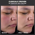 Paula's Choice 2% BHA Liquid Exfoliant 30 mL