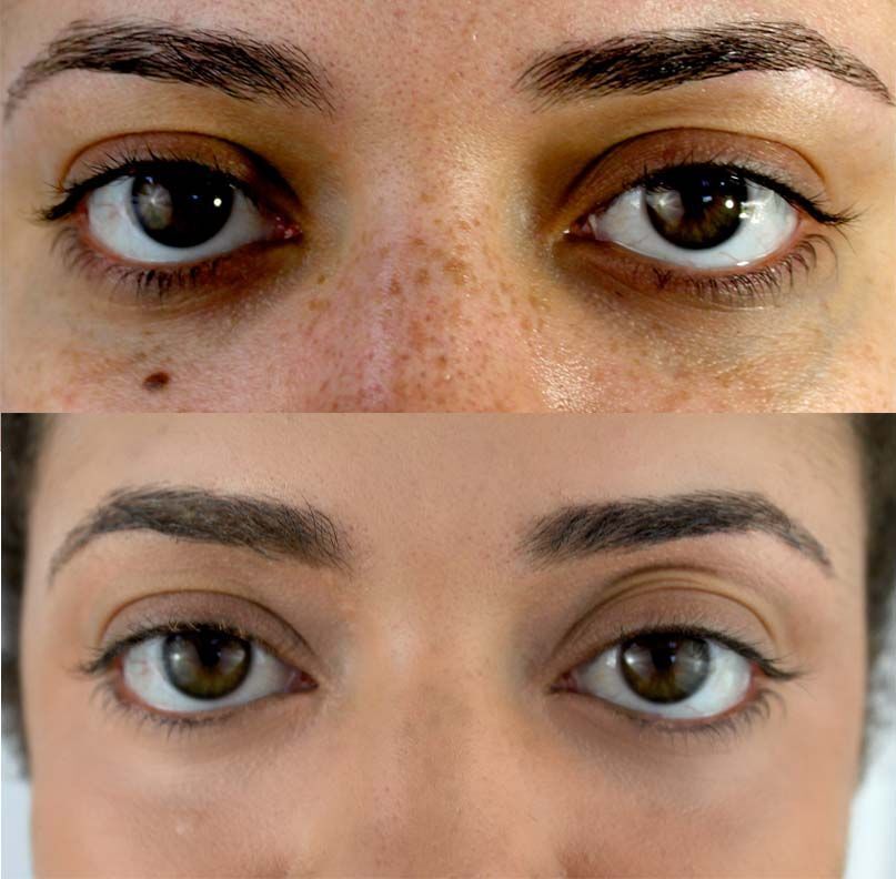 IT Cosmetics Bye Bye Illumination Under Eye Concealer