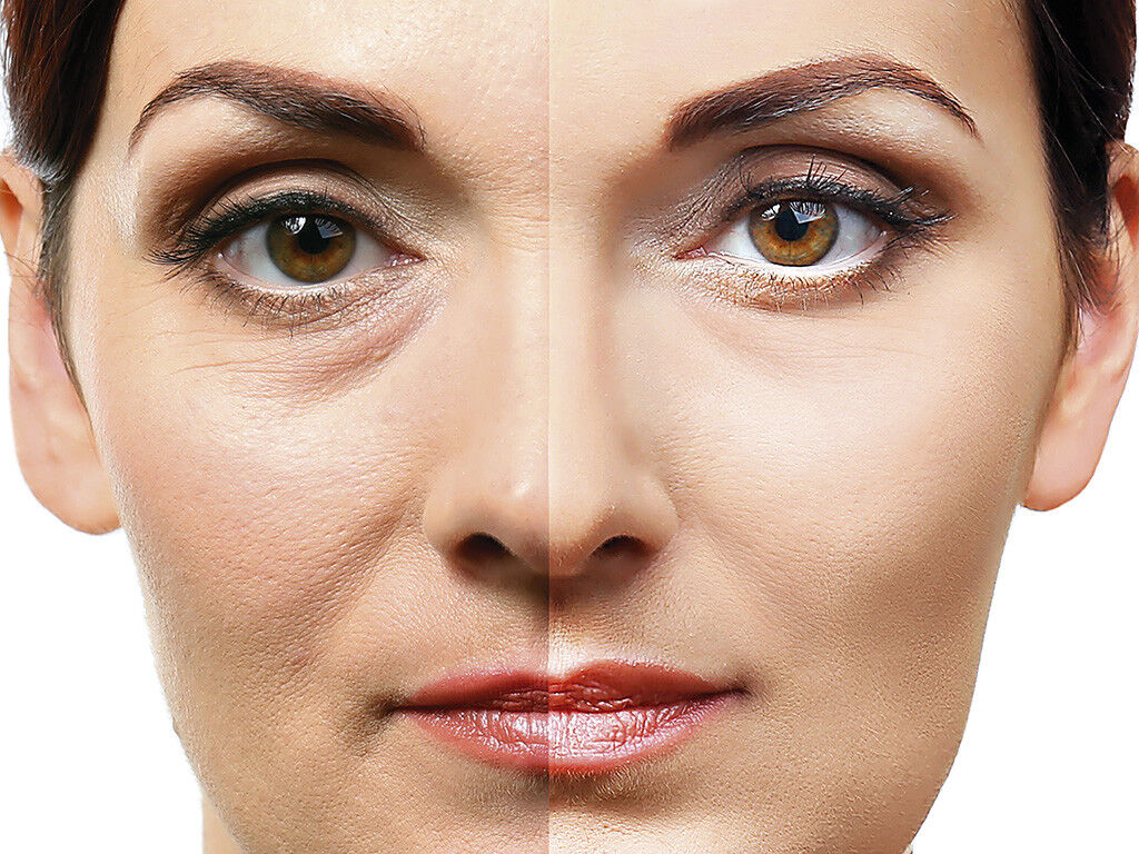 Eyesential Face Lift – Special Offer £29.95 + Gift!