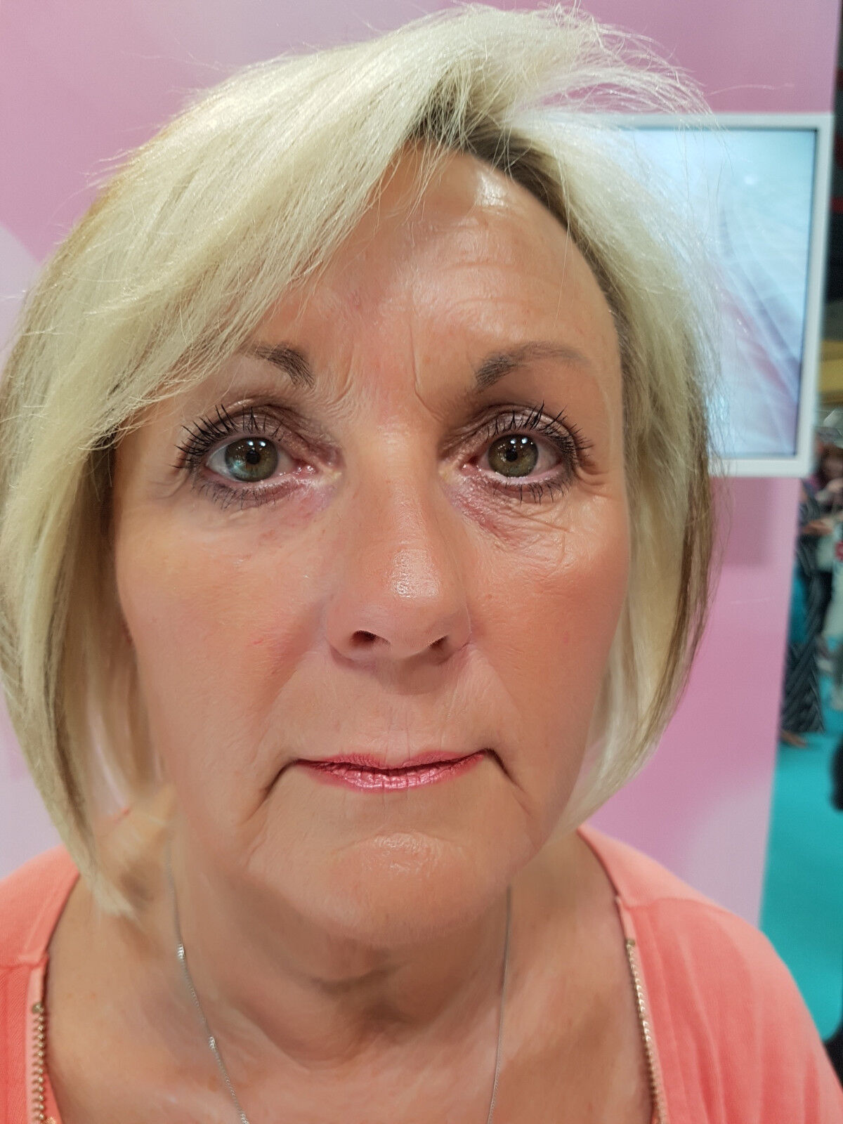 Eyesential Face Lift – Special Offer £29.95 + Gift!