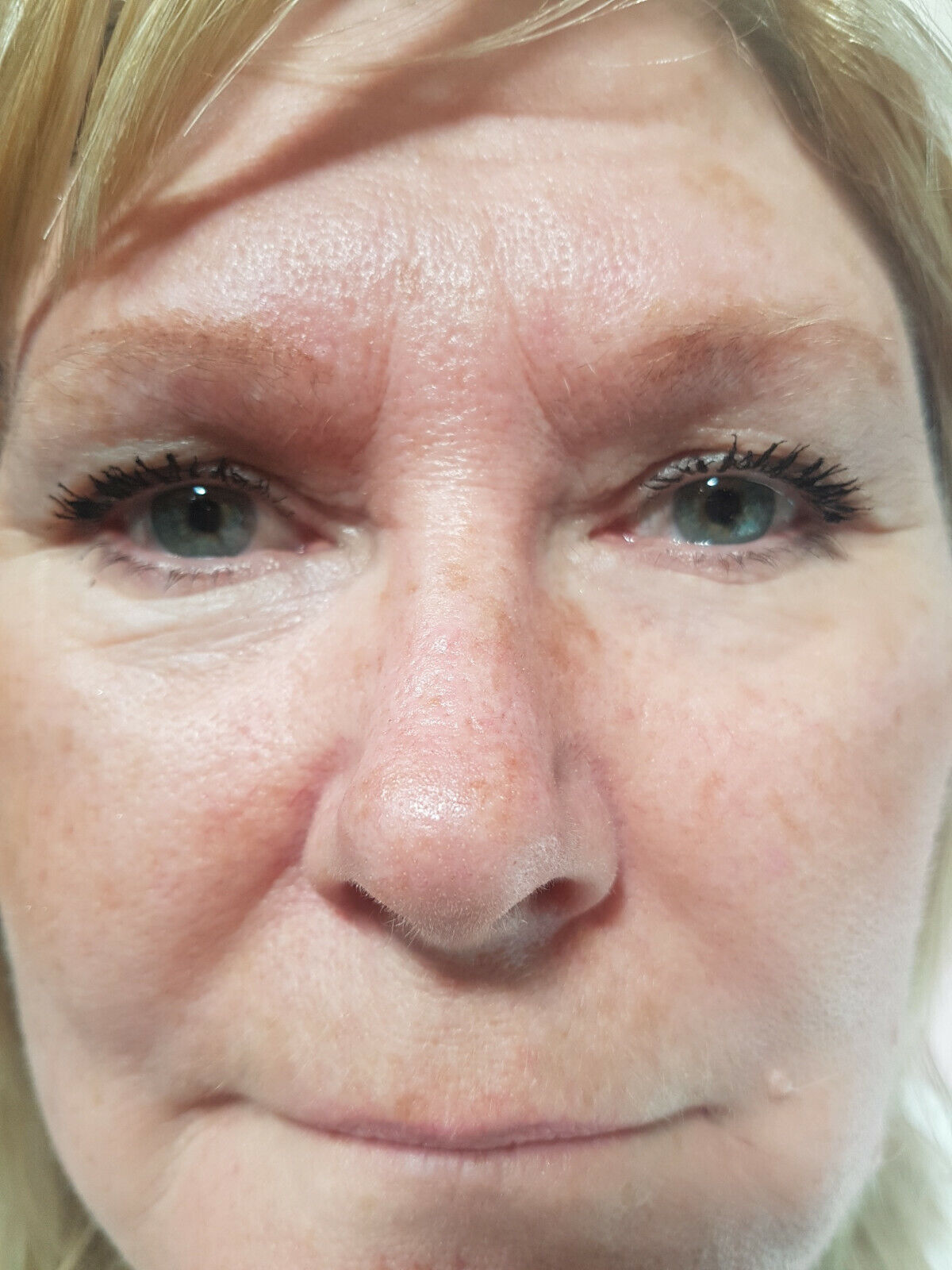 Eyesential Face Lift – Special Offer £29.95 + Gift!