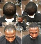 Hair Fibers Refill Bag - Dark Grey & Pepper