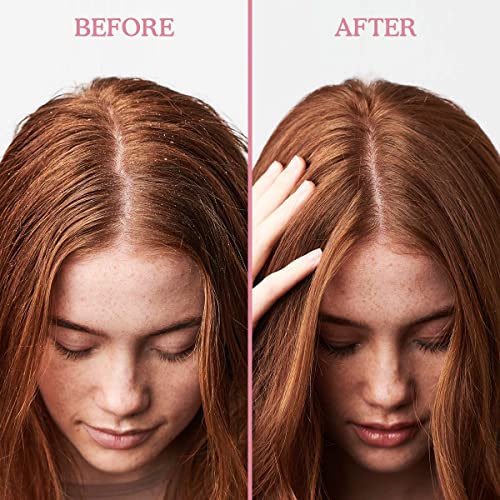 Umberto Giannini Scalp Rescue Anti-Dandruff Mask