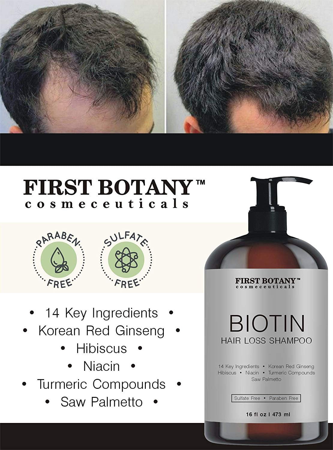 Biotin Hair Growth Shampoo with DHT Blockers