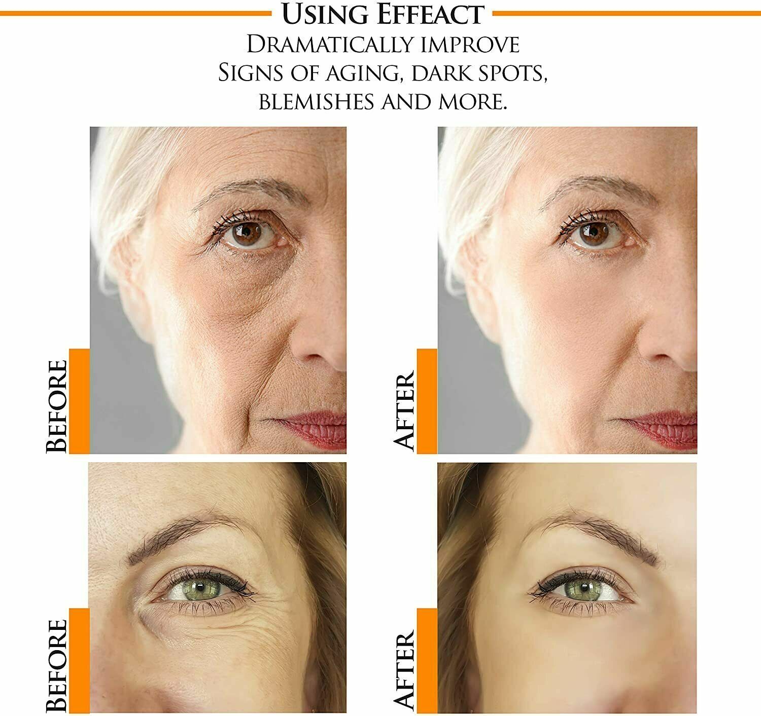 Vitamin C Retinol Face Serum for Youthful Skin