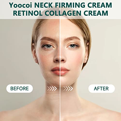 Neck Firming Cream with Retinol and Collagen