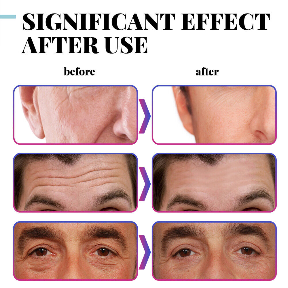 Men's Anti-Aging Wrinkle Cream with Retinol & Collagen