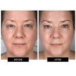 CurrentBody Skin LED Face Mask for Anti-Aging