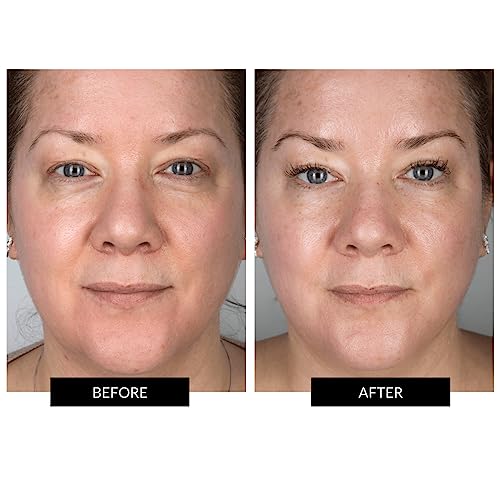 CurrentBody Skin LED Face Mask for Anti-Aging