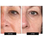 CurrentBody Skin LED Face Mask for Anti-Aging