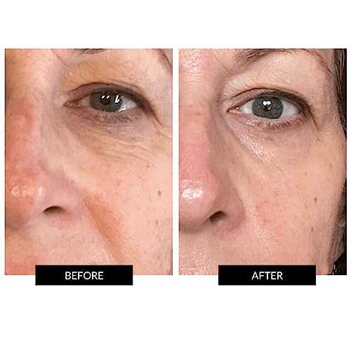 CurrentBody Skin LED Face Mask for Anti-Aging