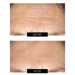 CurrentBody Skin LED Face Mask for Anti-Aging