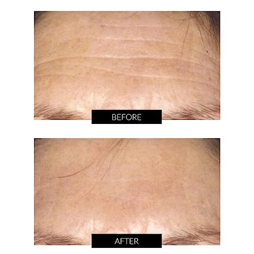 CurrentBody Skin LED Face Mask for Anti-Aging