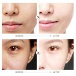 Anti-Aging Serum Capsules with Hyaluronic Acid