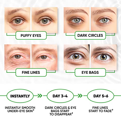 Green Tea Collagen Under-Eye Patches for Puffiness