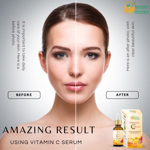 Herbs Botanica Hydrating Vitamin C Serum 1 fl oz