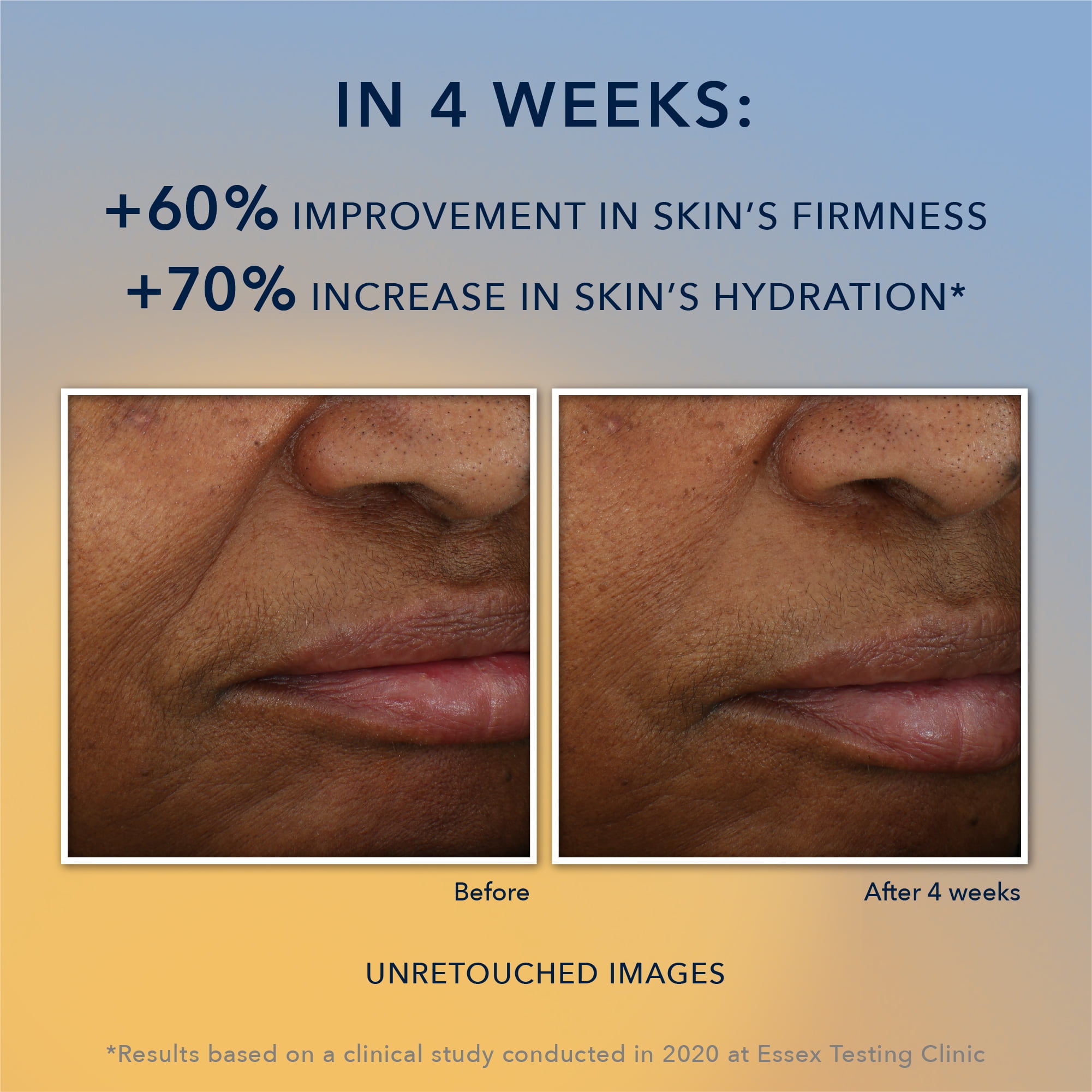 RoC Multi Correxion Vitamin C Anti-Aging Moisturizer