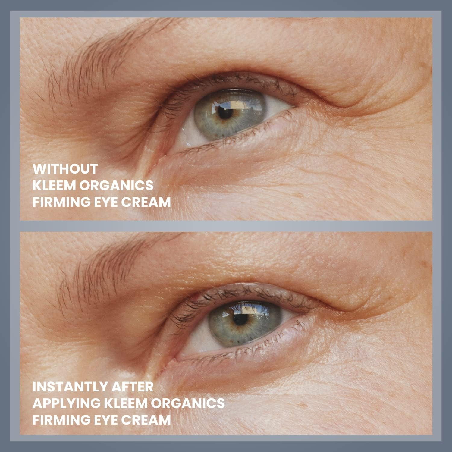 Hydrating Anti-Aging Eye Gel with Hyaluronic Acid