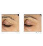 RoC Retinol Anti-Aging Eye Cream for Dark Circles