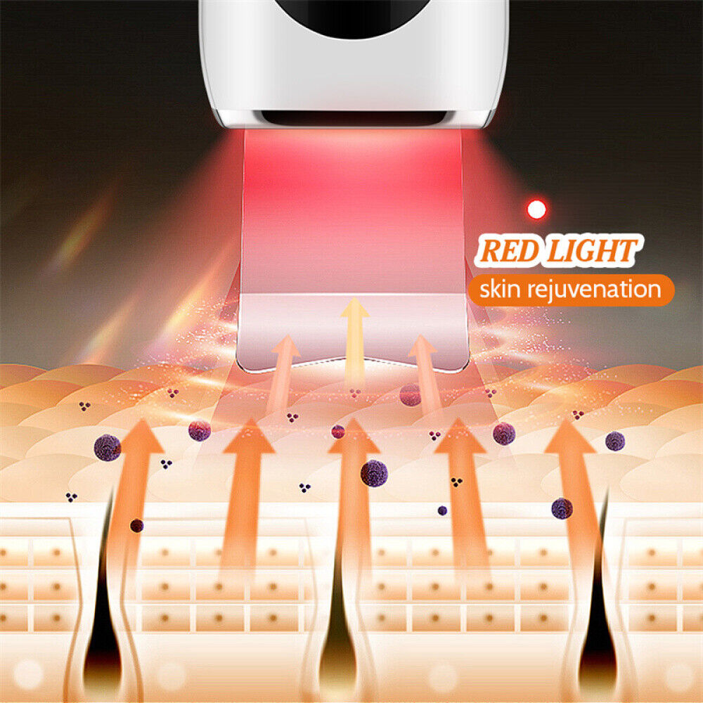 Ultrasonic Face Scrubber for Deep Cleansing