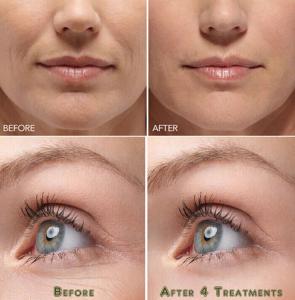 Hyaluronic Acid Anti-Aging Gel Cream Moisturizer