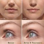 Hyaluronic Acid Anti-Aging Gel Cream Moisturizer