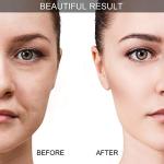 Silicone Facial Cupping Set for Anti-Aging Care