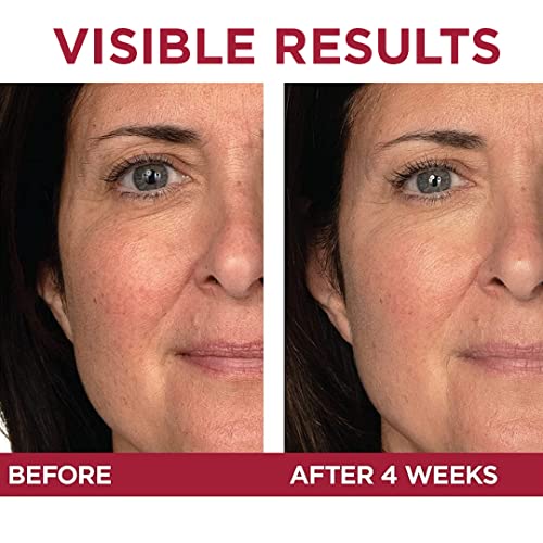 L'Oreal RevitaLift Triple Power Eye Treatment 0.5oz
