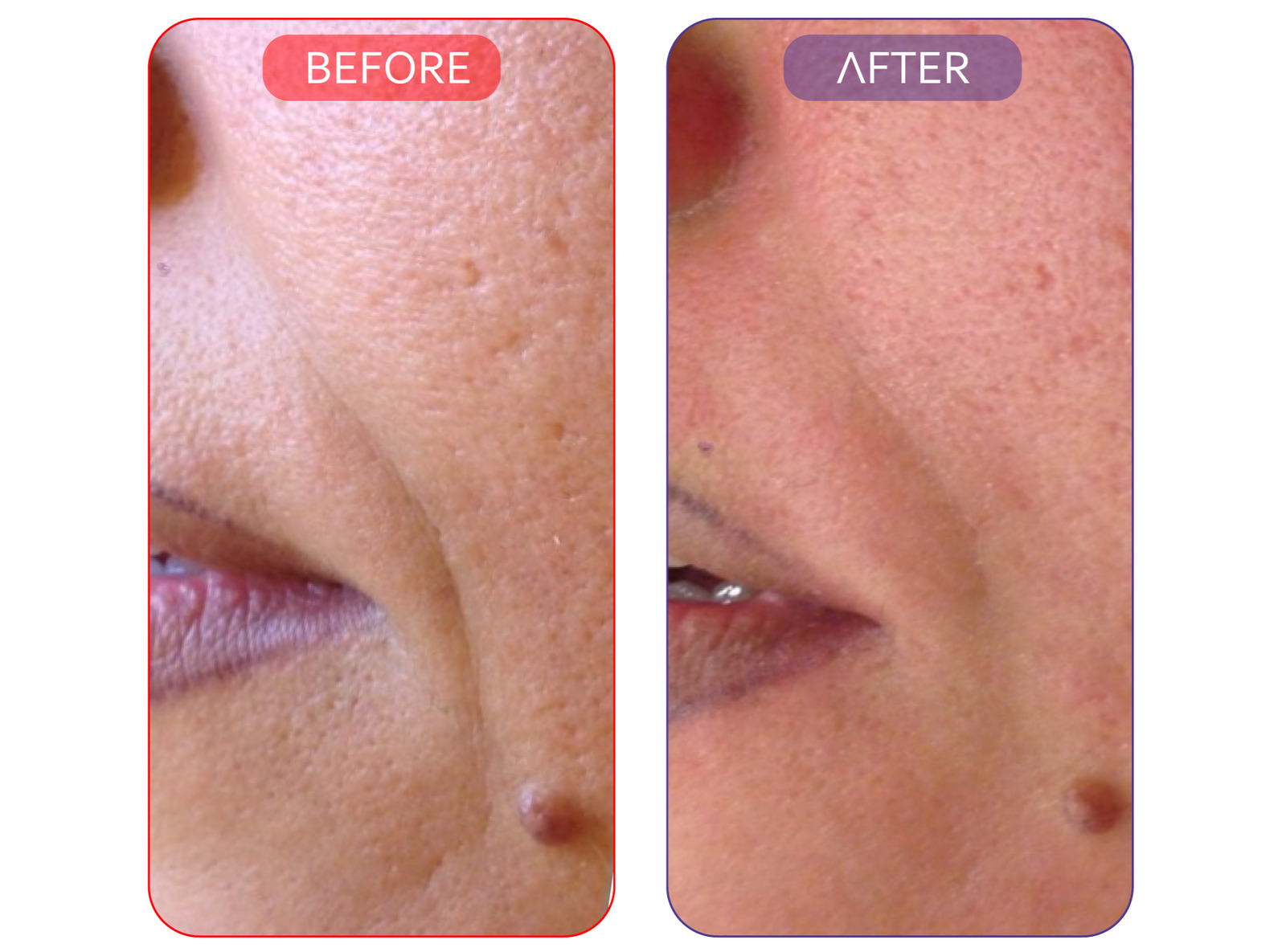All-in-One Skincare Set for Youthful Skin