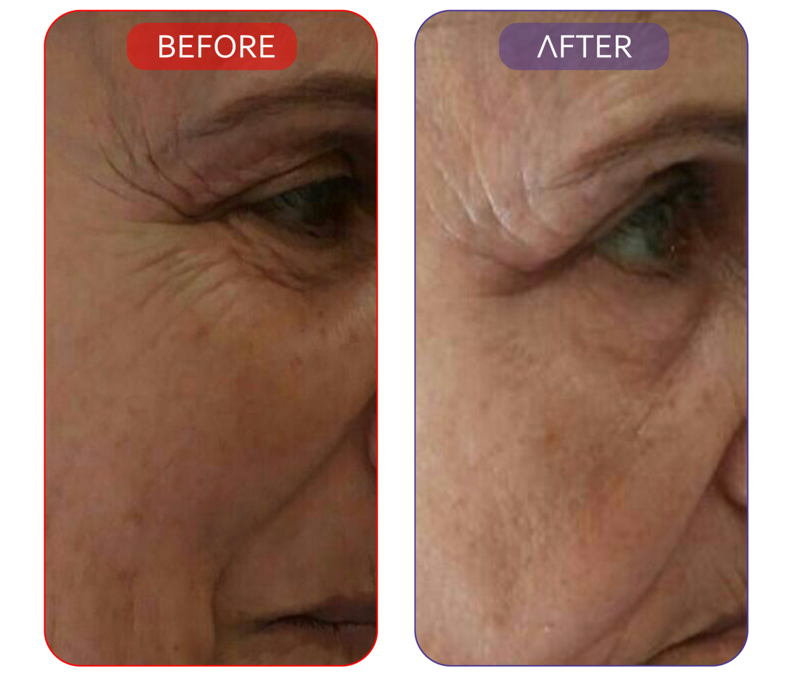 All-in-One Skincare Set for Youthful Skin