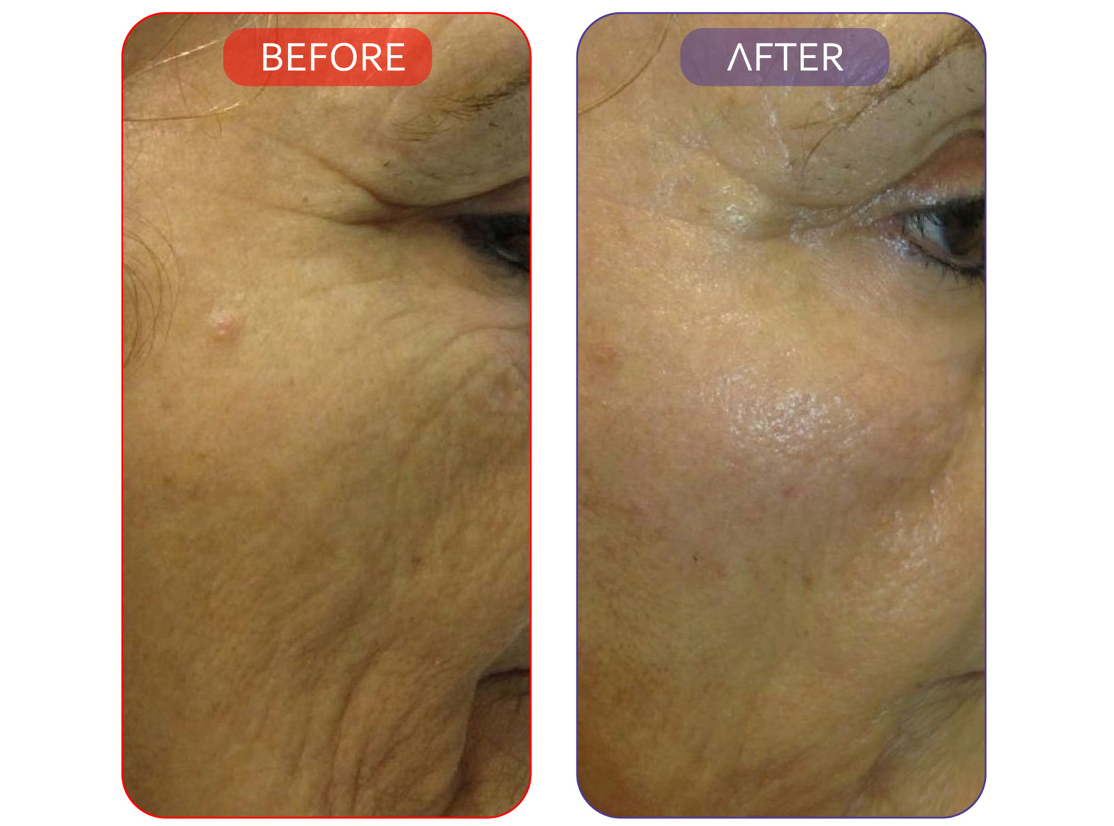 All-in-One Skincare Set for Youthful Skin