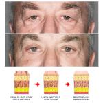 Retinol Eye Cream for Dark Circles and Puffiness