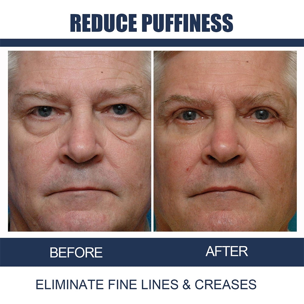 Retinol Eye Cream for Dark Circles and Puffiness