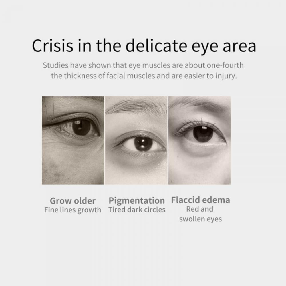 Caffeine Eye Cream for Wrinkles and Dark Circles