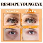 Brightening Vitamin C Eye Cream for Dark Circles