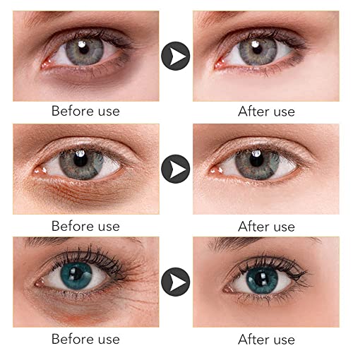 Instant Eye Cream for Bags, Puffiness, and Wrinkles