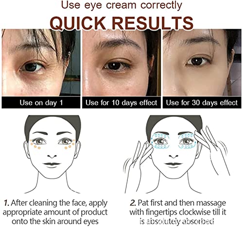 Instant Eye Cream for Bags, Puffiness, and Wrinkles