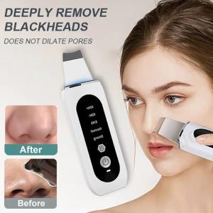 Ultrasonic Skin Scrubber for Deep Cleansing