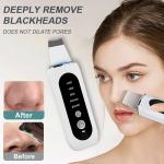 Ultrasonic Skin Scrubber for Deep Cleansing